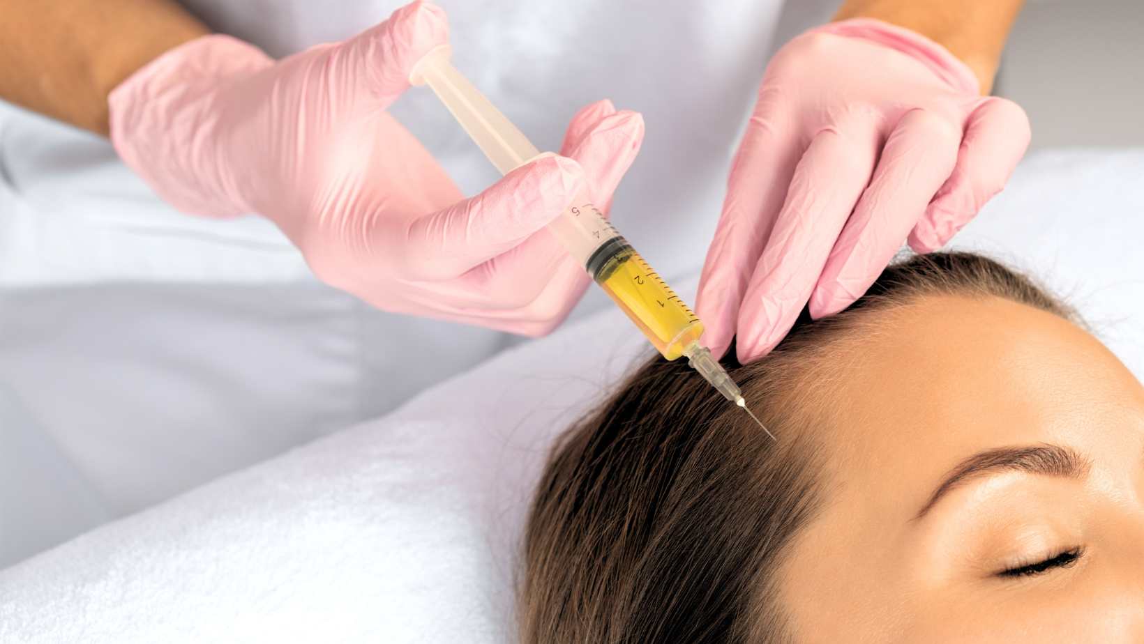 The Science of PRP Therapy for Hair Loss